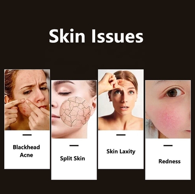 Compact Skin Led Facial Light Therapy per il miglioramento dell' acne di grado professionale