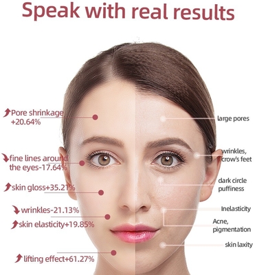 USB carica occhio bacchetta di luce terapia bacchetta Ems Vibrating Face Massager Lifting occhio 46G